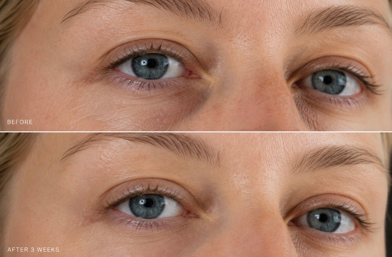 EJB Ceramide Renewal Eye Cream