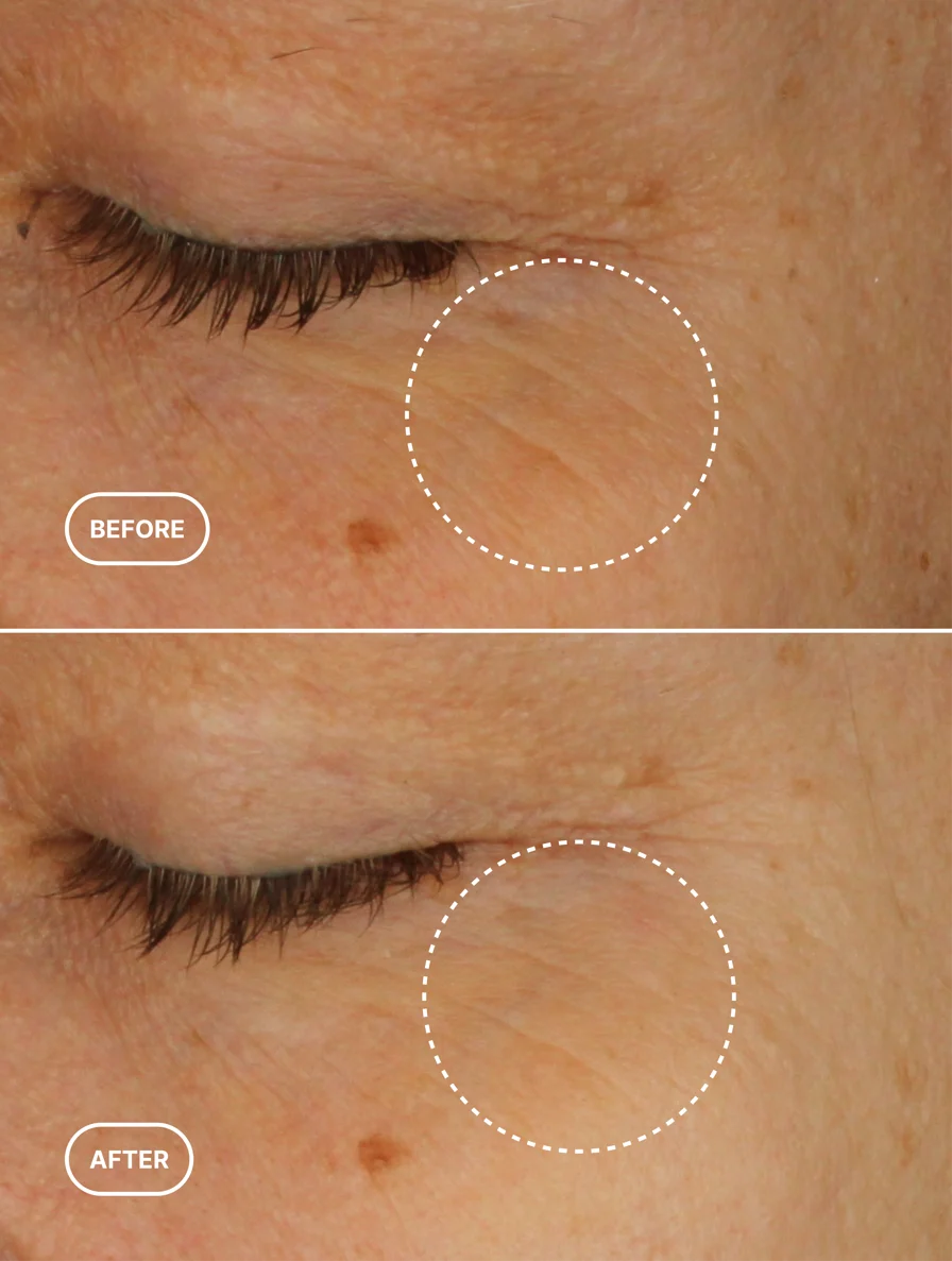 EJB Smooth + Lift Eye Serum