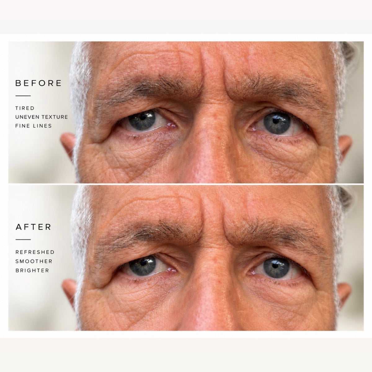 EJB Gold Renewal Eye Patches - Anti Aging