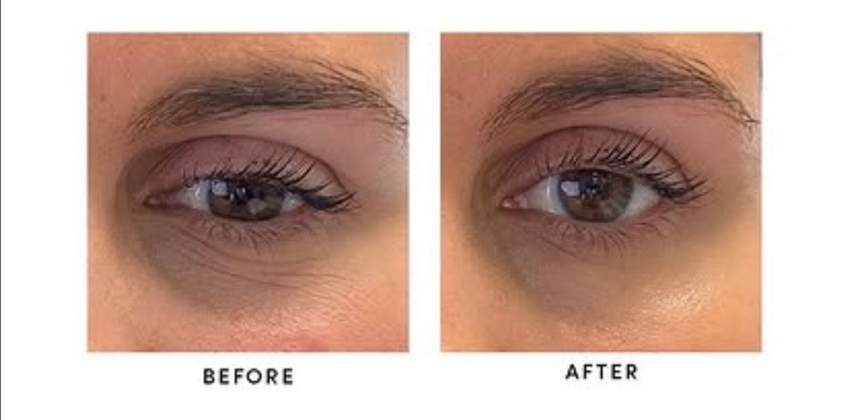 EJB Hydrogel Eye Patches