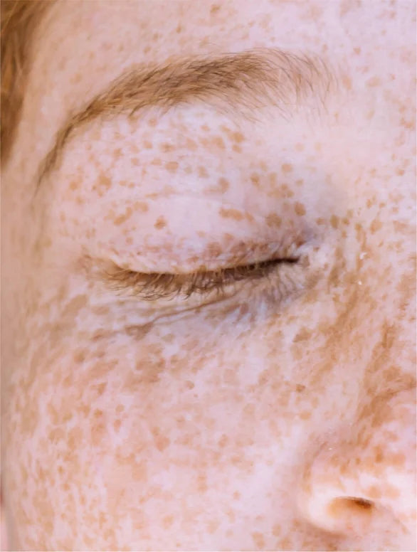 EJB Kojic Acid Dark Spot Corrector